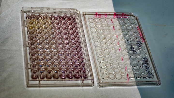 Гейтс предупредил мир о биотерроризме и получил неудобные вопросы: Когда и кто?