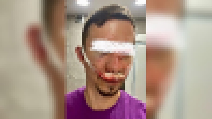 В Краснодаре мигранты избили местного жителя за сделанное им замечание