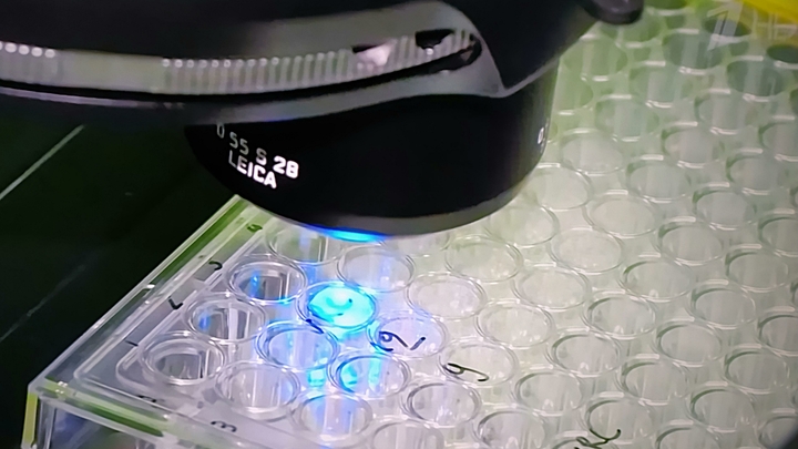 Испытуемый умер, но вакцина безопасна: В Оксфорде оправдались за смерть добровольца