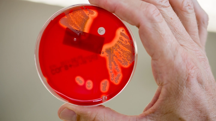 Результаты оказались шокирующими: Учёные сообщили о массовом переносчике стафилококка