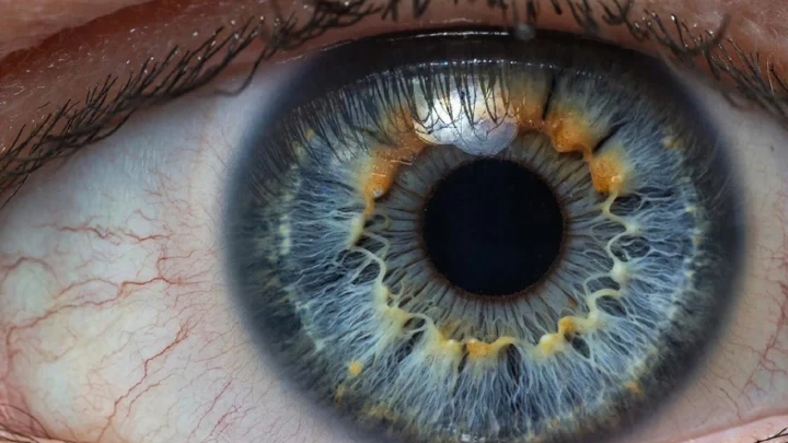 Не гаджеты виноваты: учёные назвали неожиданную причину эпидемии близорукости