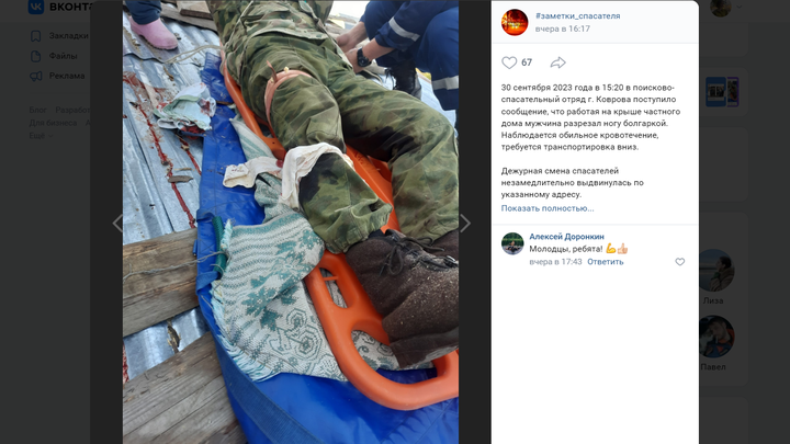В Коврове мужчина случайно разрезал себе ногу болгаркой