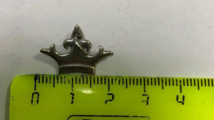 Новороссийские врачи достали из пищевода ребёнка металлическую корону