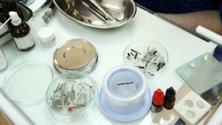 На чём экономят стоматологические клиники в России: Осторожнее стоит быть с коронками - врач