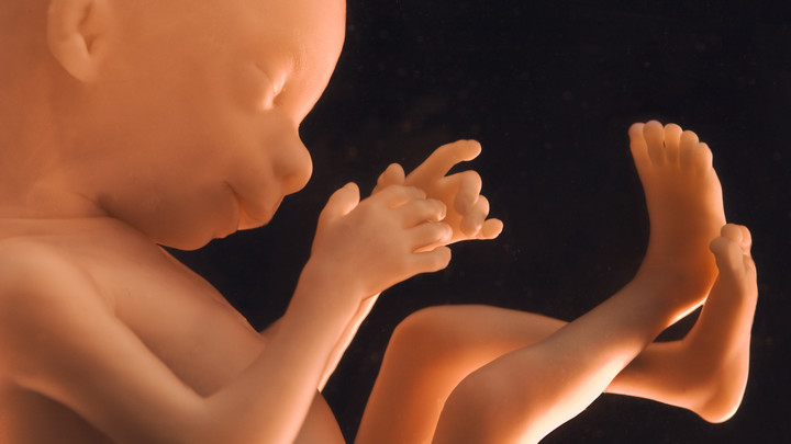 В Ирландии парламент легализовал аборты, отказав нерожденным детям даже в обезболивании