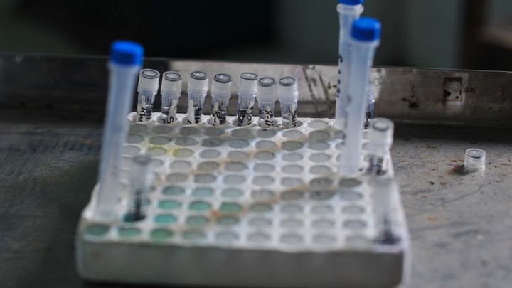 Эксперт Роспотребнадзора: Рост заболеваемости коронавирусом в России исключать нельзя