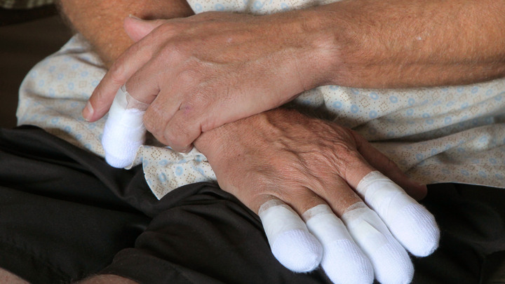 Ковидные пальцы и сыпь: Врач рассказал, как распознать бессимптомный коронавирус