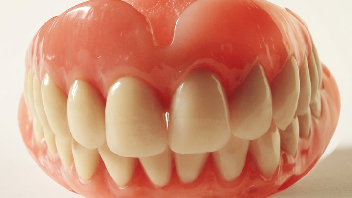 Когда можно и когда нельзя ставить зубной имплант: Совет профессионального стоматолога