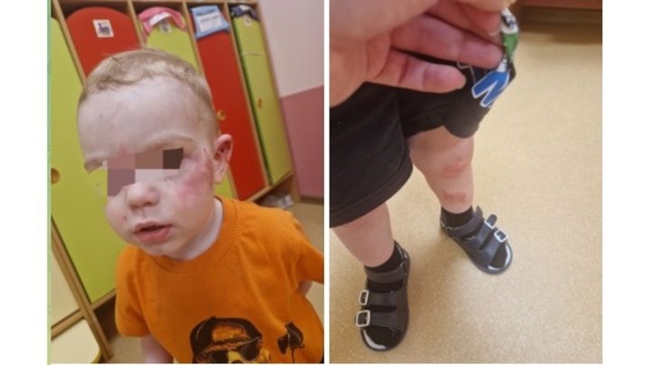 Кто избил 2-летнего ребенка в детсаду под Воронежем, выясняет СК