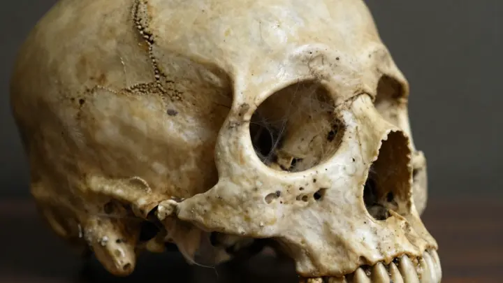 В Британии нашли останки 17-летнего викинга со следами трепанации
