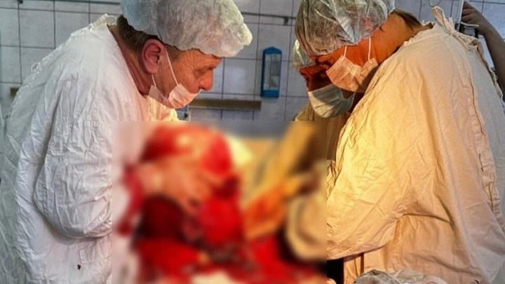 Опухоль с арбуз: челябинка 10 лет не была у врача