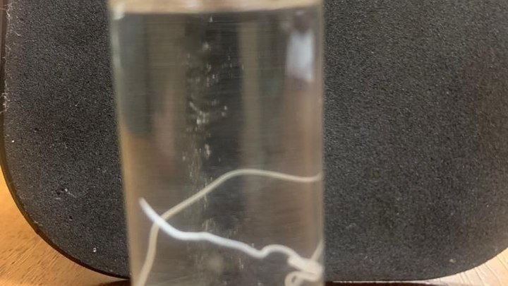 Новороссийские врачи извлекли из тела пациента 15-сантиметрового червя