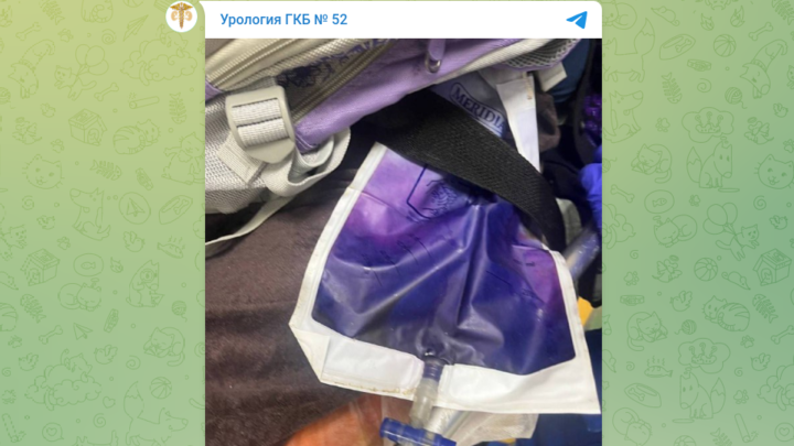 Врач Воробьев рассказал о причинах фиолетового цвета мочи