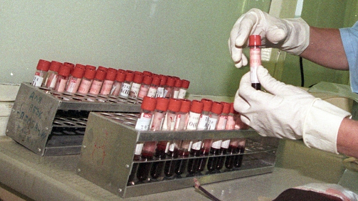 В Минздраве Беларуси назвали две области с наибольшим количество новых ВИЧ-инфицированных