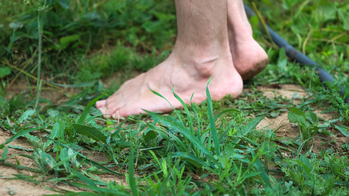 Остановить варикозное расширение вен возможно. Достаточно трёх условий