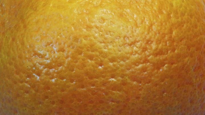 Диетолог разбила популярный миф о целлюлите: Провоцирующих продуктов не существует?