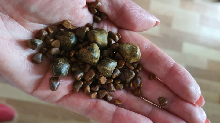 Место жительства влияет на образование камней в почках