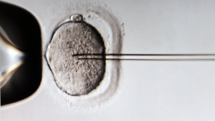 Отдавшая яйцеклетки измучалась от мыслей о малыше: Женщина рассказала о жестоком бизнесе
