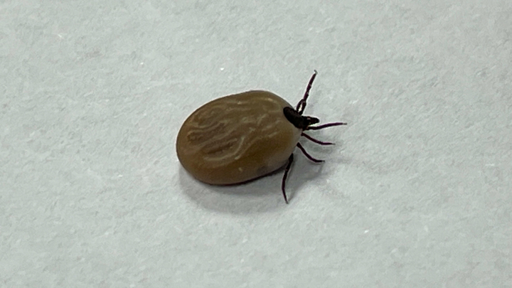 Куда кусает энцефалитный клещ: эксперт назвал лакомые части тела для кровососущего