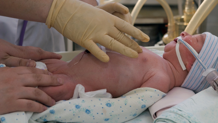 Больница в Миассе заплатит 1 млн руб. за ошибку во время беременности пациентки