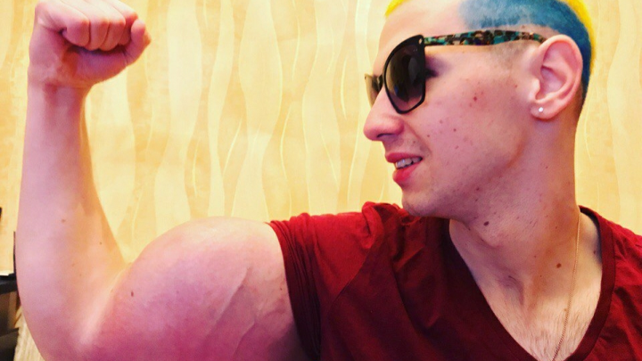 Базуки превратятся в культи: хирурги не могут спасти конечности фрика Кирилла Терёшина