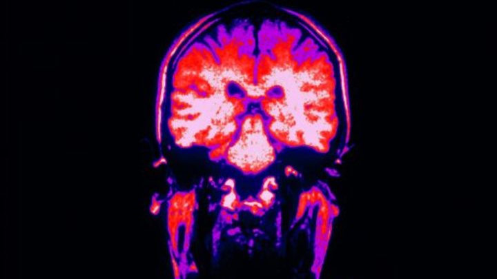 Учёные России работают над процессом выращивания нейронов мозга