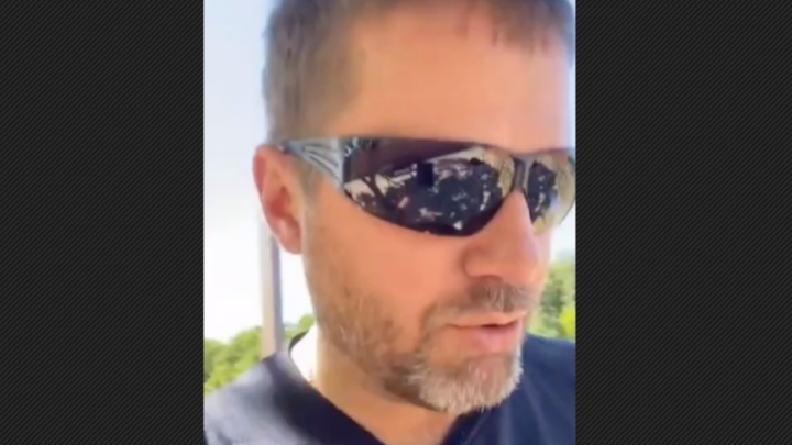 Пластический хирург Дикарев объявил награду за подробности о судьбе лица девочки, изуродованной собакой