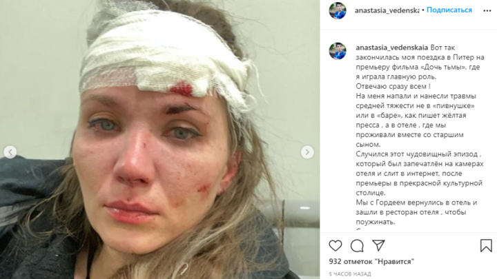 Пострадавшая в драке на Марата актриса Веденская была лучшего мнения о петербуржцах