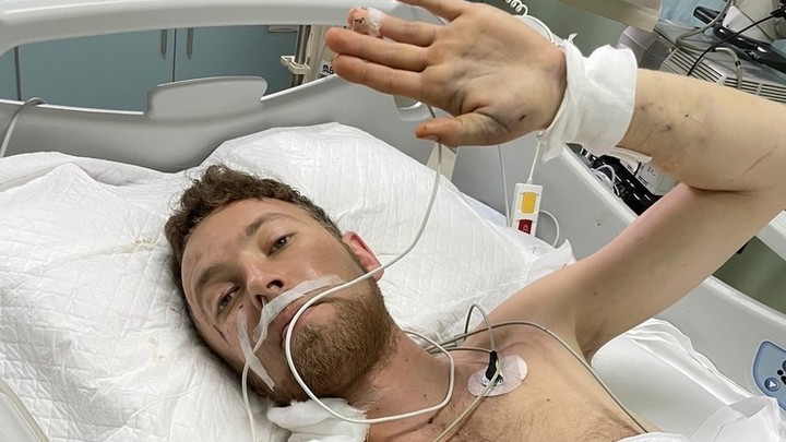 Каждый день в клинике стоит 200 тысяч рублей: уралец чудом выжил, упав с балкона в Китае