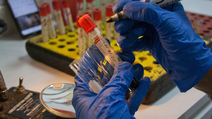 Почему медикам так интересен безымянный палец: Врач назвала три причины