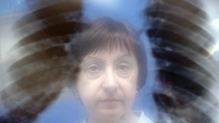 В Роспотребнадзоре назвали причину вспышки пневмонии в уральском лагере