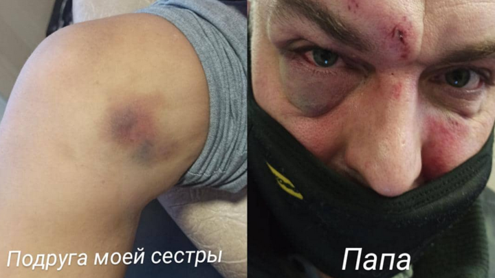 Избили железными трубами и лопатами: в Петербурге трое мужчин набросились на семью