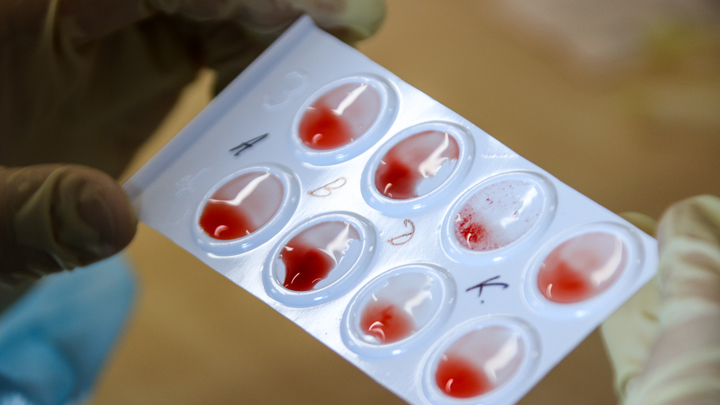 Учёные выяснили, людей с какой группой крови не берёт коронавирус