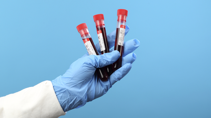 Болеют чаще и тяжелее: Люди с какой группой крови наиболее подвержены COVID?