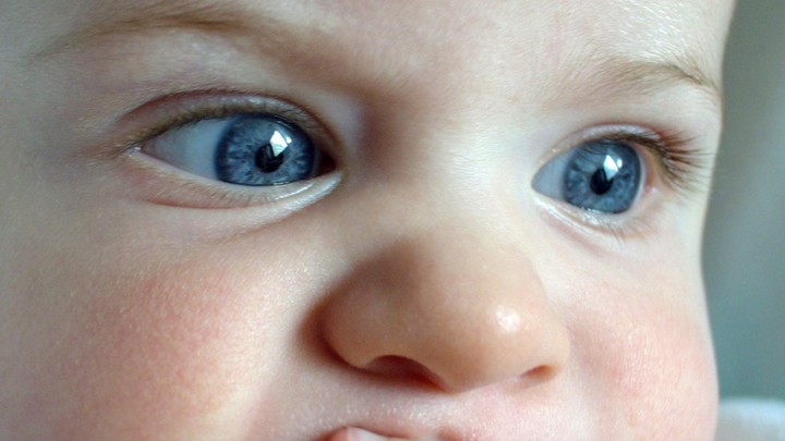 Daily Mirror: американка родила младенца с руками Халка