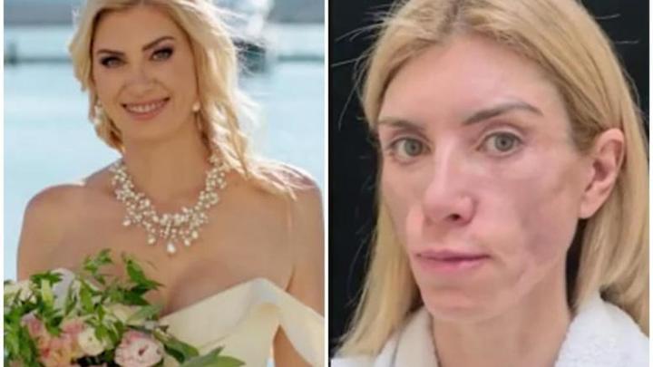 Суд Краснодара рассмотрел апелляционную жалобу по делу пластического хирурга, изуродовавшего модель