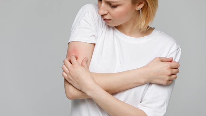 Неподдающийся лечению супергрибок. На 500% выросла заболеваемость в Европе