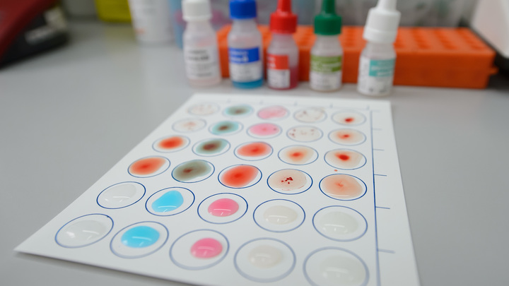 Искусственные сосуды научились создавать отечественные учёные