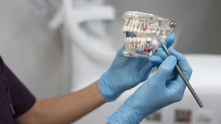 Итальянские стоматологи попали в тюрьму за удаление 11 здоровых зубов пациентке