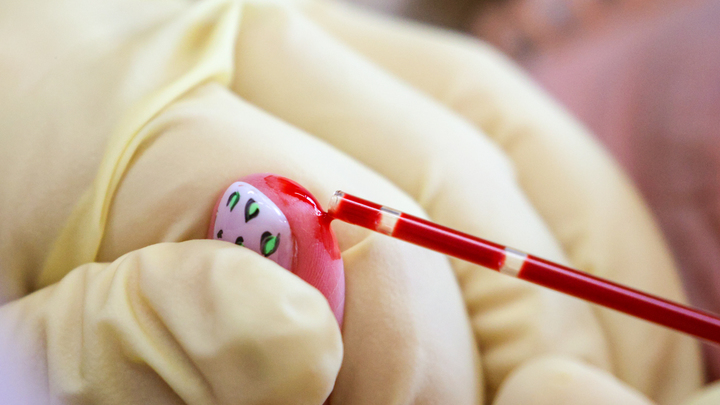 Серьёзный рост заболеваемости ВИЧ-инфекцией зафиксирован в уральском городе