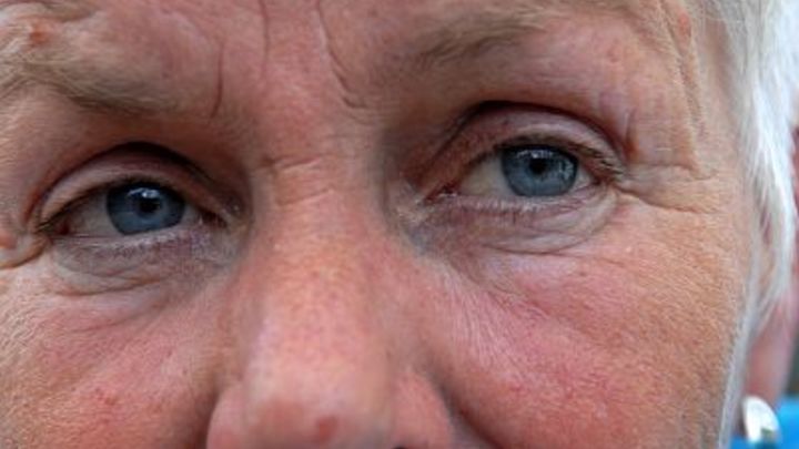 Дерматолог назвала причины преждевременного появления морщин на лице