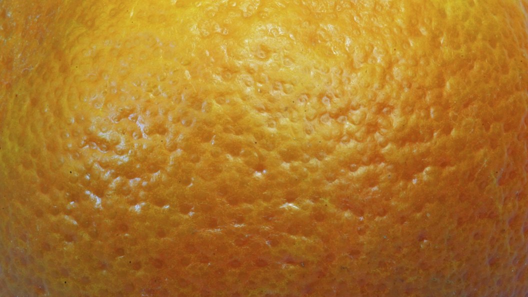 Рак груди апельсиновая корка фото