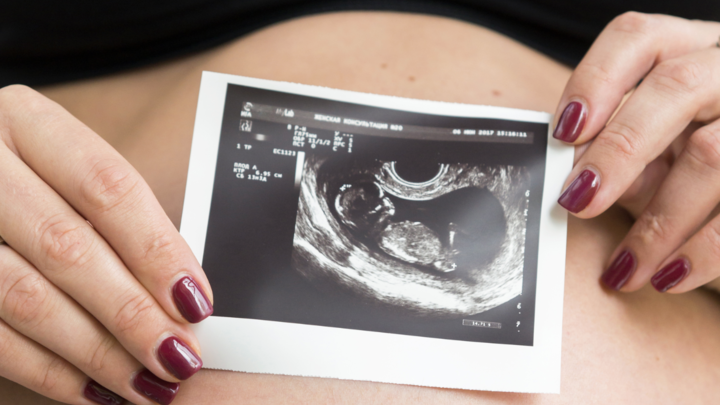 Беременная женщина спросила про последний день в жизни, и вскоре её не стало: Трагедия в Краснодаре с рухнувшим BMW получила неожиданный поворот