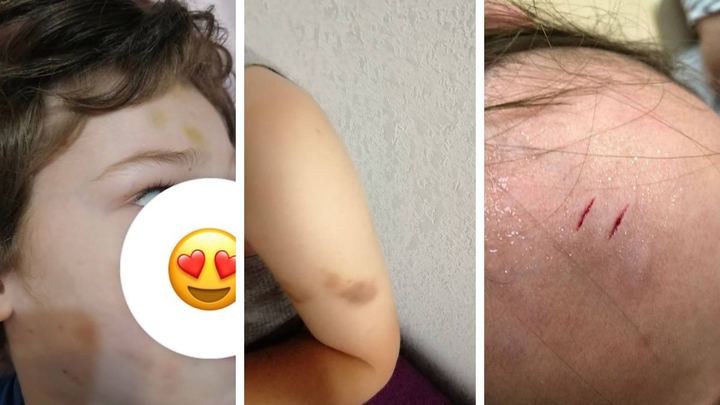 В детском саду Краснодара воспитатель избивала детей-инвалидов