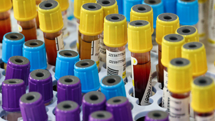 В Новосибирске врачи рассказали о симптомах коронавируса летом 2023 года