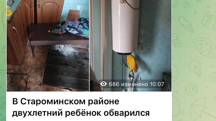 В Староминском районе полиция изучает обстоятельства получения ожогов годовалым ребёнком