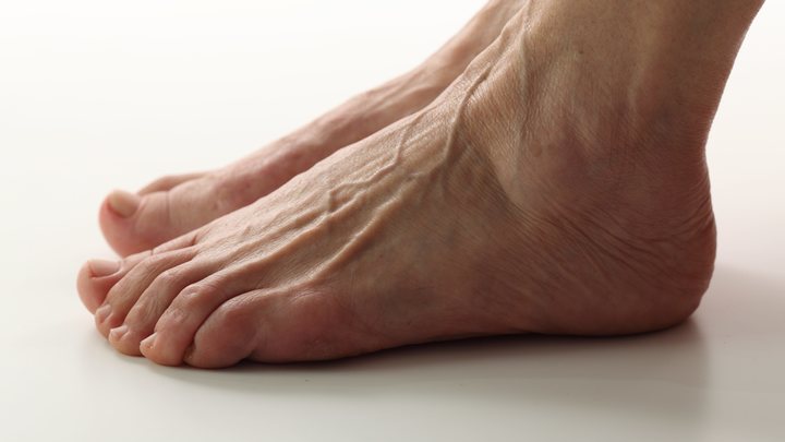 Мясников предупредил о смертельной опасности варикоза