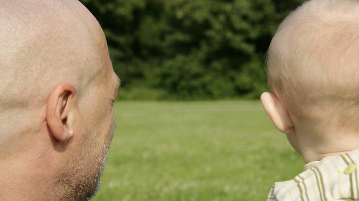 Учёные выяснили, от чего люди лысеют: Проверено на мышах