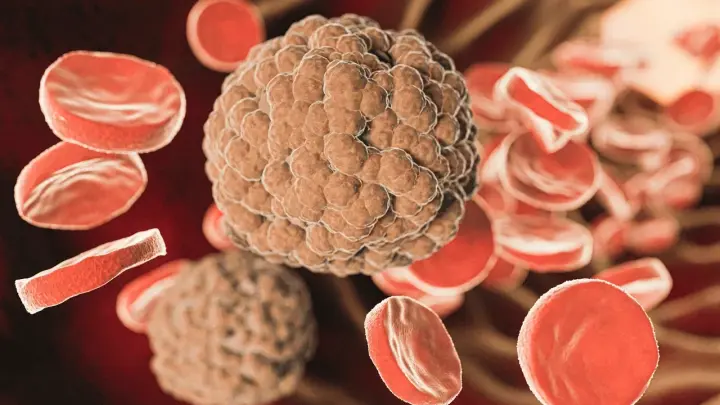 Малышева раскритиковала пациентку с раком, отказавшуюся от лечения по совету психолога