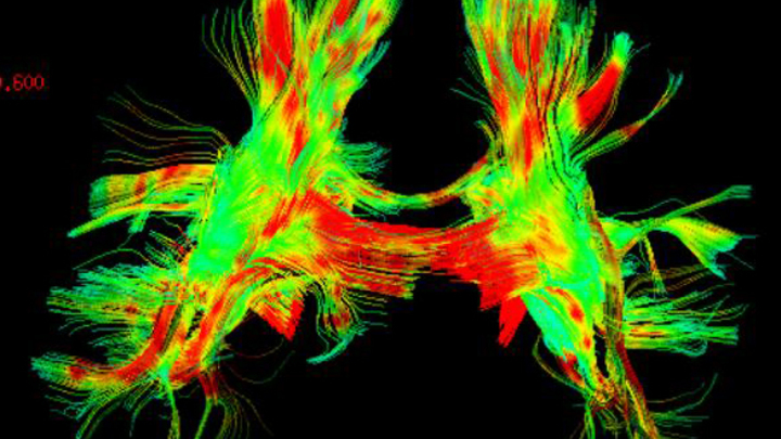 Кожа может думать? Американские учёные сделали необычное открытие